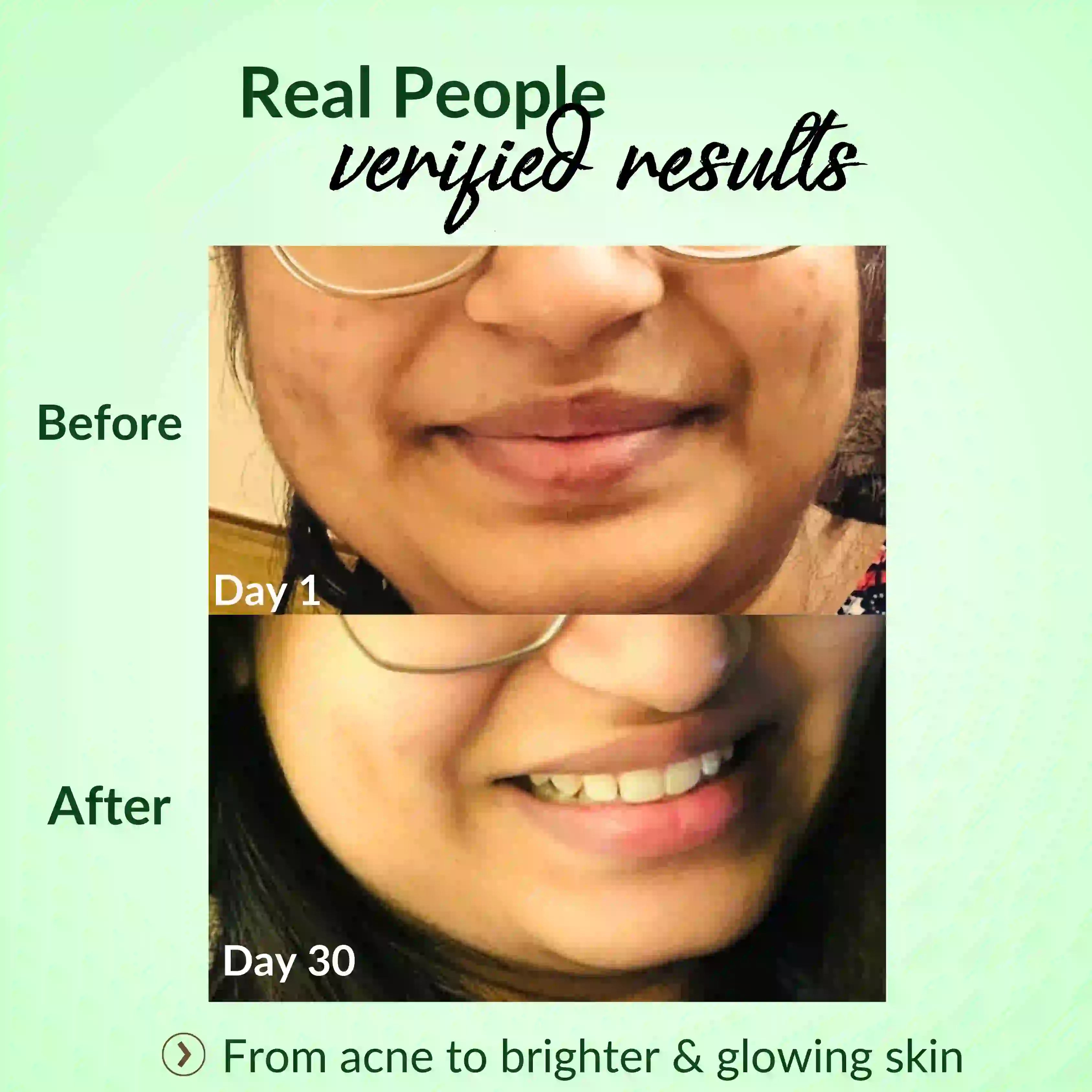 Hazelnut Essentials Green Tea acne control face wash _results